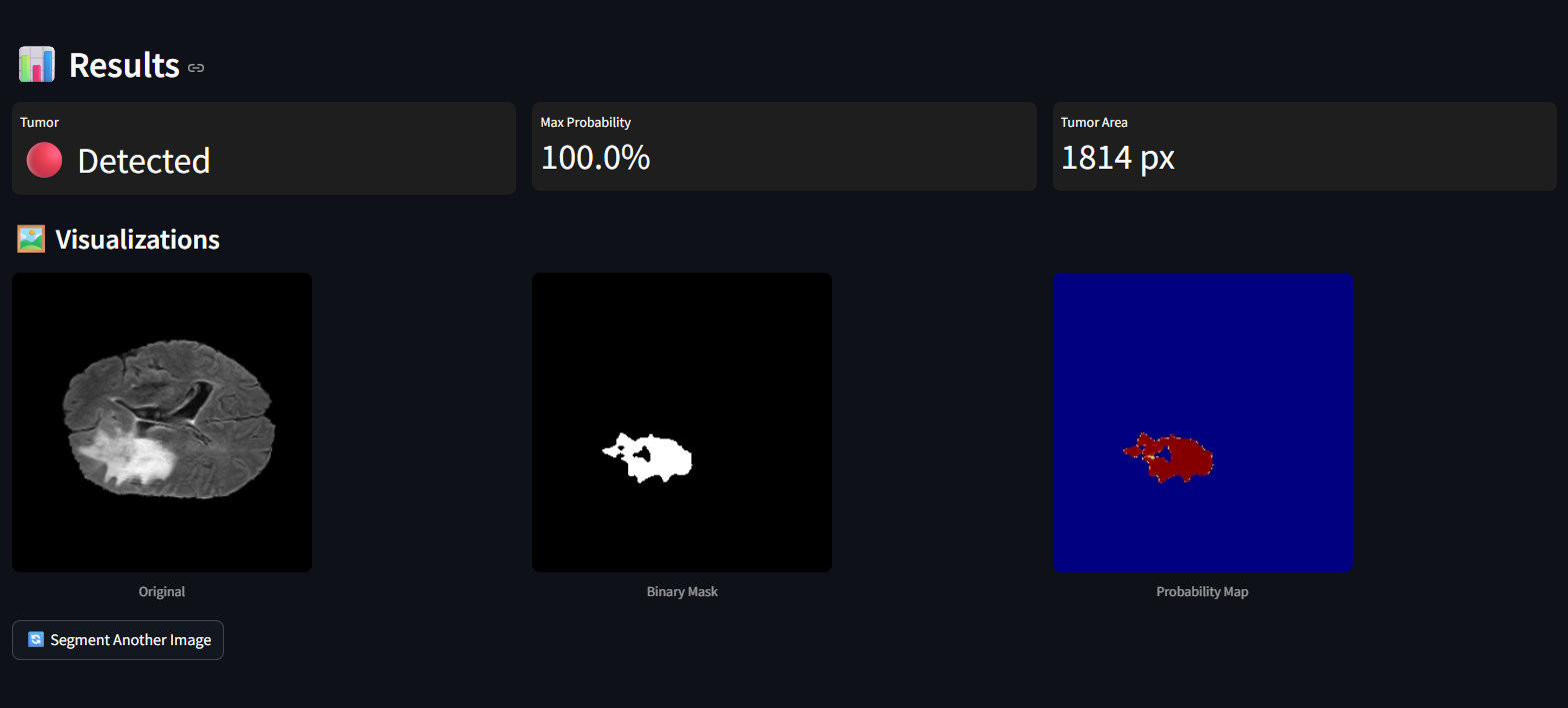 SliceWise results panel showing detection confidence, binary mask, and probability map side-by-side